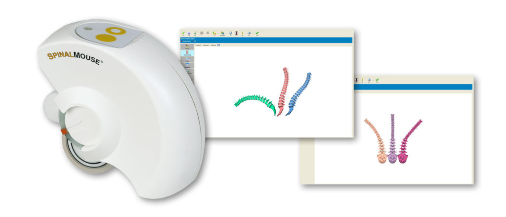 BackScan screening results